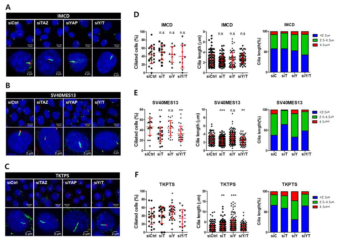 tubule cell별 YAP/TAZ의 감소에 의한 섬모 형성 변화 관찰