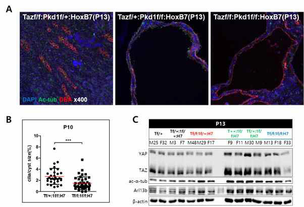 Collecting duct 특이적인 Pkd1결함에 의해 발생한 ADPKD모델에서도 적용되는 TAZ에 의한 일차 섬모 형성 조절 확인