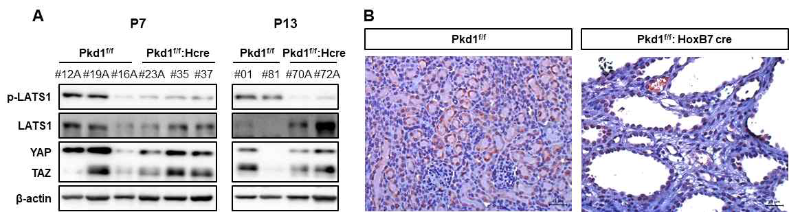 집합관 특이적인 Pkd1 결함 마우스 모델에서 Yap/Taz 발현 스크리닝