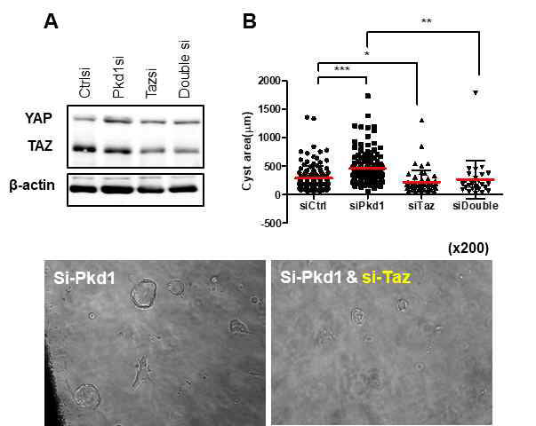 Taz 발현 저해에 따른 in vitro 낭포 형성 억제 효과 검증