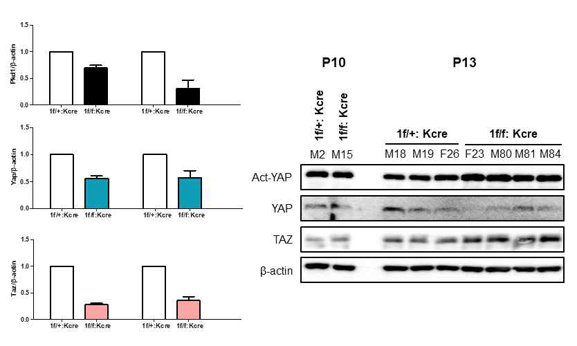 Pkd1f; Ksp cre 모델 스크리닝