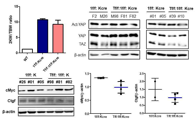 Taz 결함 Pkd1f; Ksp cre 스크리닝