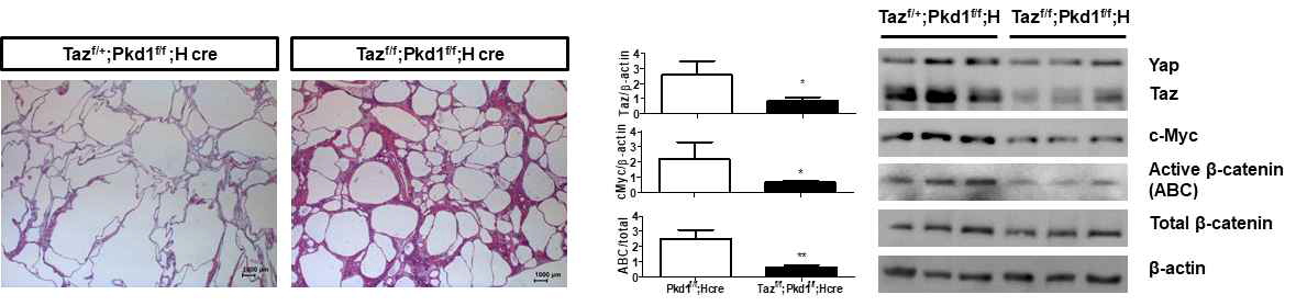 Taz 결함 유도 Pkd1f/f; HoxB7 cre 신장 histology 및 c-Myc, β-Catenin 레벨 검증