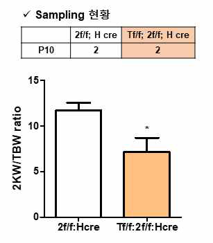 Taz 결함 Pkd2f; HoxB7 cre 표현형 관찰