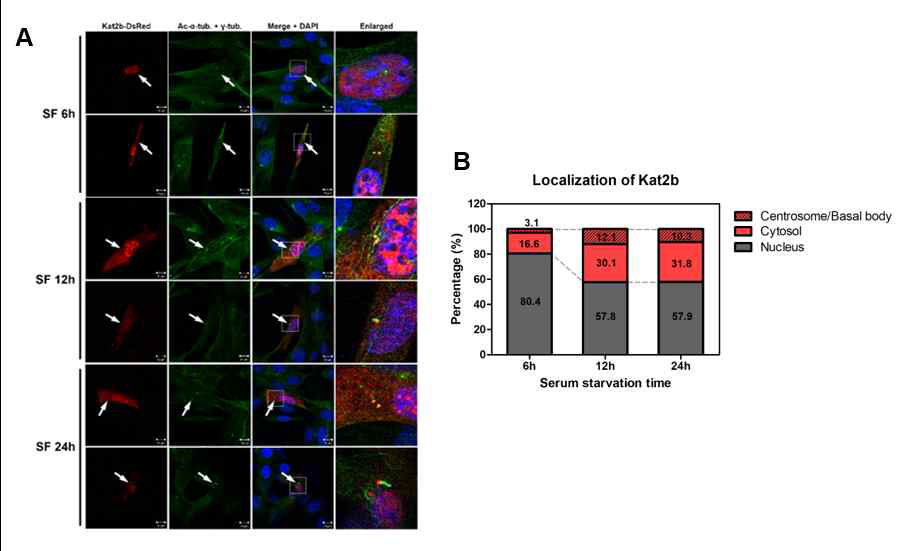 섬모 형성 과정 중 Kat2b의 세포 내 위치 확인