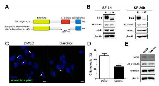 Kat2b의 Acetyltransferase 기능의 섬모 조절 효과 확인