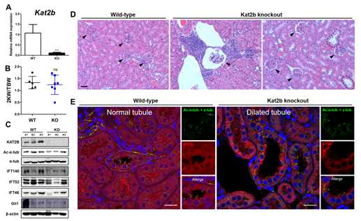 Kat2b KO 마우스의 신장 조직 표현형 및 섬모 결함 확인