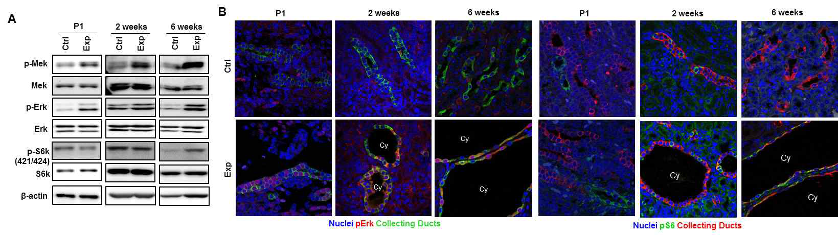 Ick cKO 신장에서 MAPK 및 mTOR signaling 변화 관찰