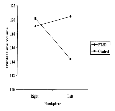 PTSD 환자군과 정상군의 좌우 전두엽 부피의 비대칭성 (O’Doherty 등. 2015)