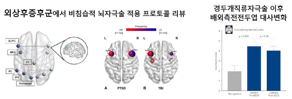 외상후증후군에서 비침습적 뇌자극술 적용 문헌 리뷰 및 예비연구 결과