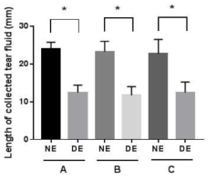 정상인과 안구건조증 모사 in vitro 환경에서 측정된 눈물 길이