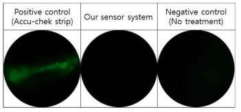 Fluorescein으로 염색된 IPC에서 얻은 대표 형광 이미지 (좌) positive control, (중) 당뇨 진단 센서, (우) negative control