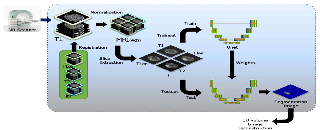 뇌종양 segmentation pipeline