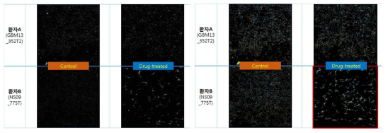 세포 표현형 특징 추출 과정 (좌) 2명 환자유래 뇌종양 세포 영상 예 (우) 개별 세포 레이블링 적용 및 랜덤 컬러 가시화 결과