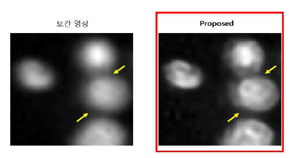 실제 저해상도 핵형광 영상(10x)의 실험 결과