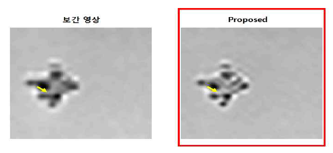 실제 저해상도 현미경 영상의 잡음 제거와 초고해상도 복원 실험 결과