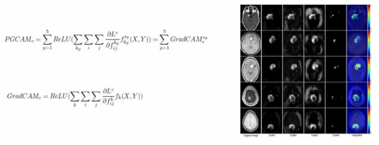PGCAM, GradCAM 알고리즘과 PGCAM의 종양부피 측정 추출 예