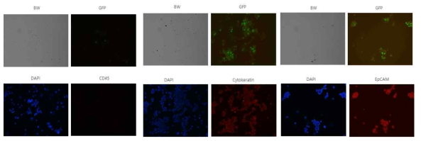 NCI-H526 cell line의 Immunocytostain 결과 (DAPI, CD45, Cytokeratin, EpCAM)