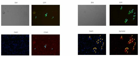 NCI-H526 cell line를 spike시킨 폐암환자 혈액에서의 Immunocytostain 결과 -1 (DAPI, CD45, EpCAM)
