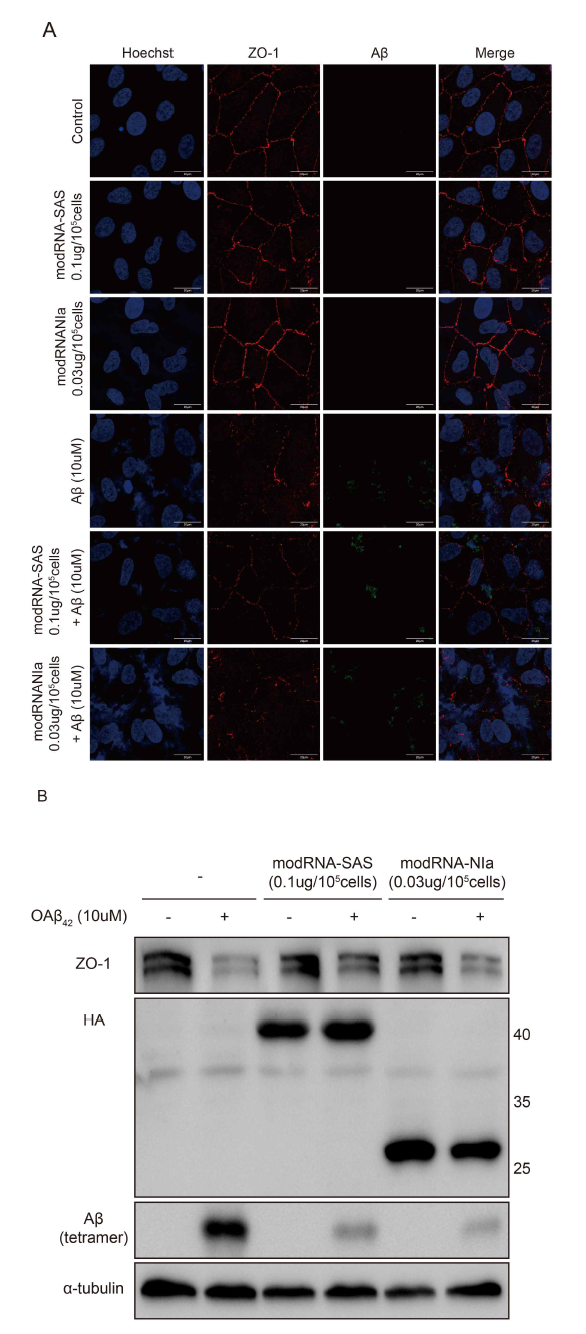 SAS의 Aβ에 의한 ARPE-19 세포 변화 저해 효과 확인 (A) 면역 형광 염색법을 통해 ARPE-19 세포의 tight juction 마커 (ZO-1)와 세포 내의 Aβ를 확인함. (B) Western blot을 통해 ARPE-19 세포의 tight juction 마커 (ZO-1)와 세포 내의 Aβ를 확인함