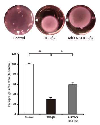 콜라겐 용액을 이용한 교원질 겔 수축실험에서 CCN5의 영향 확인 TGF-β2를 처리한 ARPE-19 세포에서는 교원질 겔의 수축력이 정상세포에 비해 현저하게 증가하며, AdCCN5의 존재하는 세포에서는 더뎌지는 것을 관찰. (*P≤0.05, **P≤0.01)