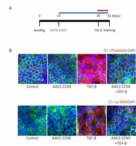 CCN5의 TGF-β2로 유도된 iPSC 유래 RPE 세포의 섬유화 예방 효과 (A) iPSC유래 RPE 세포에 AAV2-CCN5 (1.5×1011 vg/ml)을 처리한 후, TGF-β2 (10 ng/ml)를 처리함. (B) 면역 형광염색법을 통해 TGF-β2로 인해 망가지는 iPSC 유래 RPE 세포의 변화가 CCN5에 의해 유지 되는 것을 확인. 또한 α-SMA와 phalloidin의 발현이 CCN5에 의해 증가하지 않는 것이 관찰됨