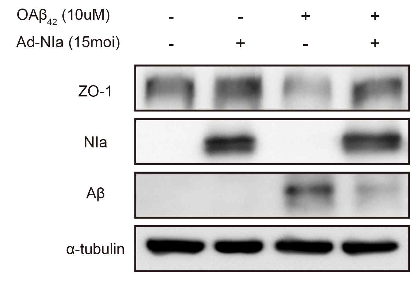 NIa의 Aβ에 의한 ARPE-19 세포 변화 저해 효과 확인 ARPE-19 세포에 15moi의 아데노 NIa 바이러스를 처리하고 24시간 후, 10μM Aβ를 처리해 24시간 뒤에 Western blot 분석법을 통해 tight junction과 세포 내 Aβ의 변화를 확인하였다. Aβ만 처리한 세 번째 레인에서는 tight junction marker인 ZO-1이 감소하였으나, 아데노 NIa 바이러스를 미리 처리해 준 네 번째 레인에서는 ZO-1이 대조군(첫 번째 레인)과 비슷한 정도로 유지됨을 확인하였다. 아데노 NIa 바이러스를 미리 처리해 준 경우(네 번째 레인), 그렇지 않은 경우(세 번째 레인)에 비하여 세포 내 Aβ가 감소함을 확인하였다