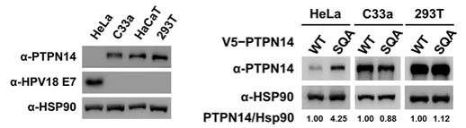 세포 별 PTPN14 단백질 발현 비교