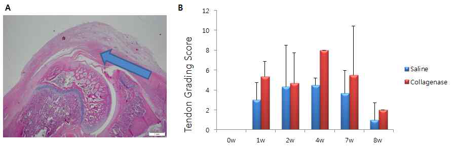 Collagenase를 이용한 극상건에서의 건병증 유도와 확인. A. 극상근에서의 collagenase 투여 부위 B. 건병증 유발 후 시간에 따른 시기별 건 조직 점수