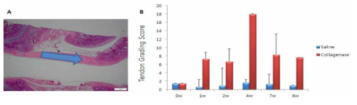 Collagenase를 이용한 슬개건에서의 건병증 유도와 확인. A. 슬개건에서의 collagenase 투여 부위 B. 건병증 유발 후 시간에 따른 시기별 건 조직 점수