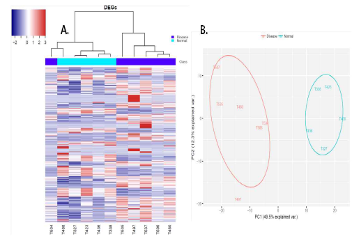 정상 및 병증 조직의 NGS data. A. Hierarchical cluster. B. Principal component analysis (PCA)