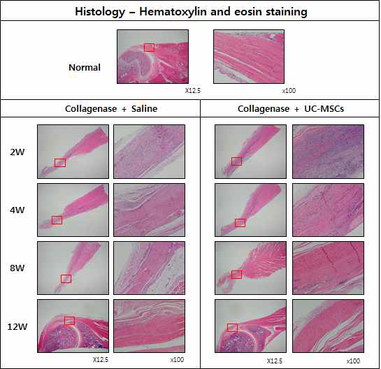 건병증이 유도된 극상건에 Saline를 주사한 그룹과 UC-MSC를 주사한 그룹의 H&E
