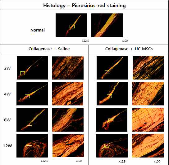 건병증이 유도된 극상건에 Saline를 주사한 그룹과 UC-MSC를 주사한 그룹의 Picrosirius red