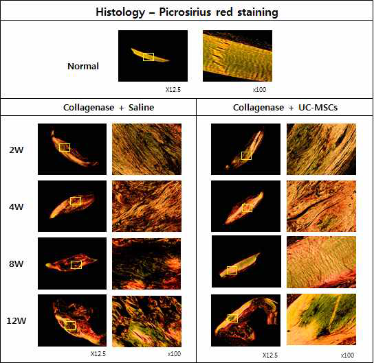 건병증이 유도된 슬개건에 Saline를 주사한 그룹과 UC-MSC를 주사한 그룹의 Picrosirius red