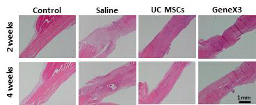 정상 극상건, Saline을 주입한 극상건, UC MSCs를 주입한 극상건, GeneX3를 강화한 UC MSCs를 주입한 극상건의 2주와 4주의 PSR 사진