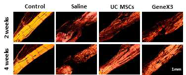 정상 극상건, Saline을 주입한 극상건, UC MSCs를 주입한 극상건, GeneX3를 강화한 UC MSCs를 주입한 극상건의 2주와 4주의 PSR 사진