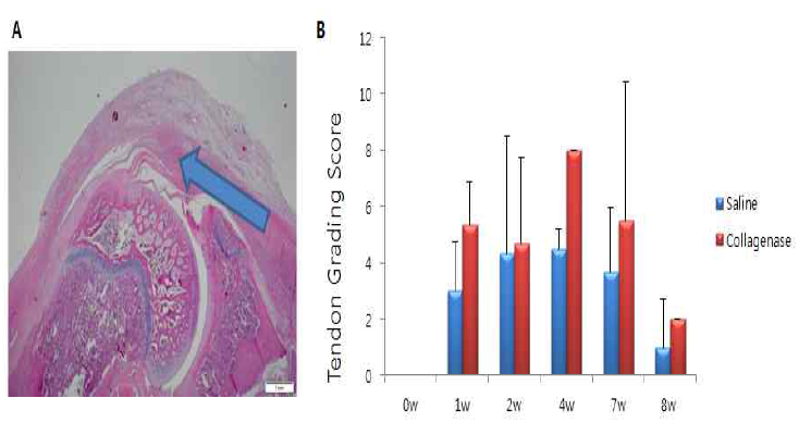 Collagenase를 이용한 극상건에서의 건병증 유도와 확인. A. 극상근에서의 collagenase 투여 부위 B. 건병증 유발 후 시간에 따른 시기별 건 조직 점수