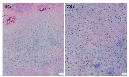 슬개건에서의 collagenase 투여 8주 후 관찰된 chondrocyte 변화 양상