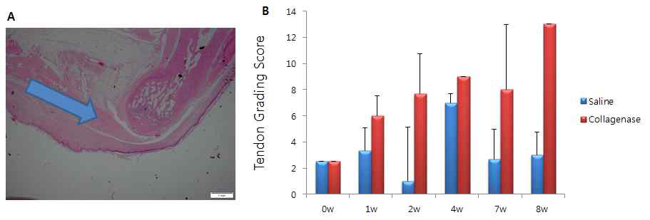 Collagenase를 이용한 아킬레스건에서의 건병증 유도와 확인. A. 아킬레스건에서의 collagenase 투여 부위 B. 건병증 유발 후 시간에 따른 시기별 건 조직 점수