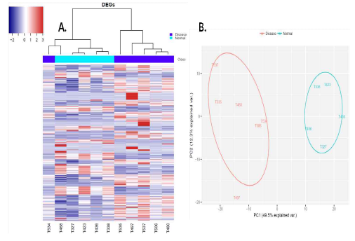 정상 및 병증 조직의 NGS data. A. Hierarchical cluster. B. Principal component analysis (PCA)