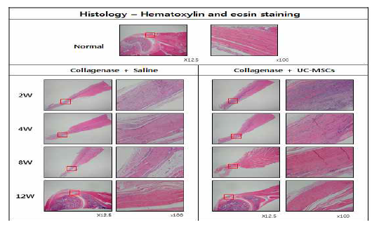건병증이 유도된 극상건에 Saline를 주사한 그룹과 UC-MSC를 주사한 그룹의 H&E
