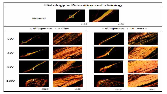 건병증이 유도된 극상건에 Saline를 주사한 그룹과 UC-MSC를 주사한 그룹의 Picrosirius red