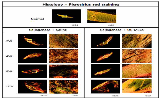 건병증이 유도된 슬개건에 Saline를 주사한 그룹과 UC-MSC를 주사한 그룹의 Picrosirius red