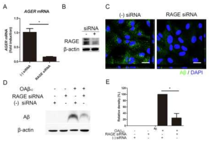 최종당화산물 수용체에 의한 아밀로이드베타의 세포내 축적