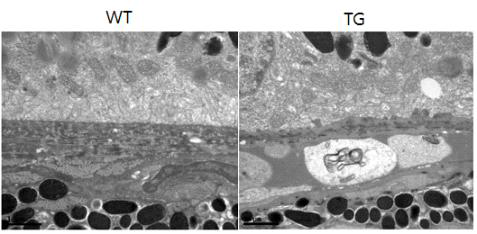 5XFAD 생쥐의 망막색소상피의 건성 노인성황반변성 특이적 미세구조변화