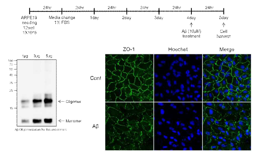 Aβ 처리 시 망막색소상피세포인 ARPE-19의 tight junction의 변화