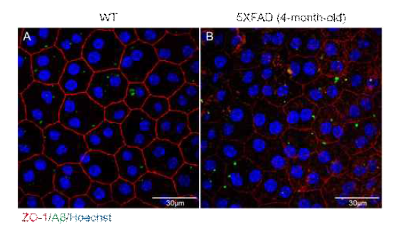 5X FAD 생쥐의 망막색소상피 내 Aβ의 축적 및 tight junction의 손상