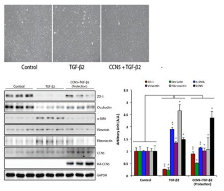 CCN5에 의한 TGF-β2 유발 EMT 억제 효과