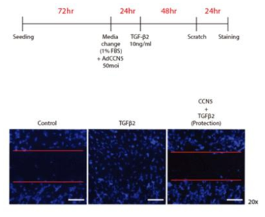 CCN5에 의한 TGF-β2 유발 세포 이동능 억제 회복