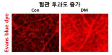 에반스 블루색소를 이용한 혈관투과성 평가